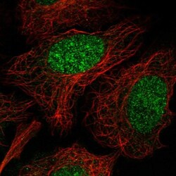Neudesin Antibody, Novus Biologicals 0.1mL; Unlabeled:Antibodies, Polyclonal